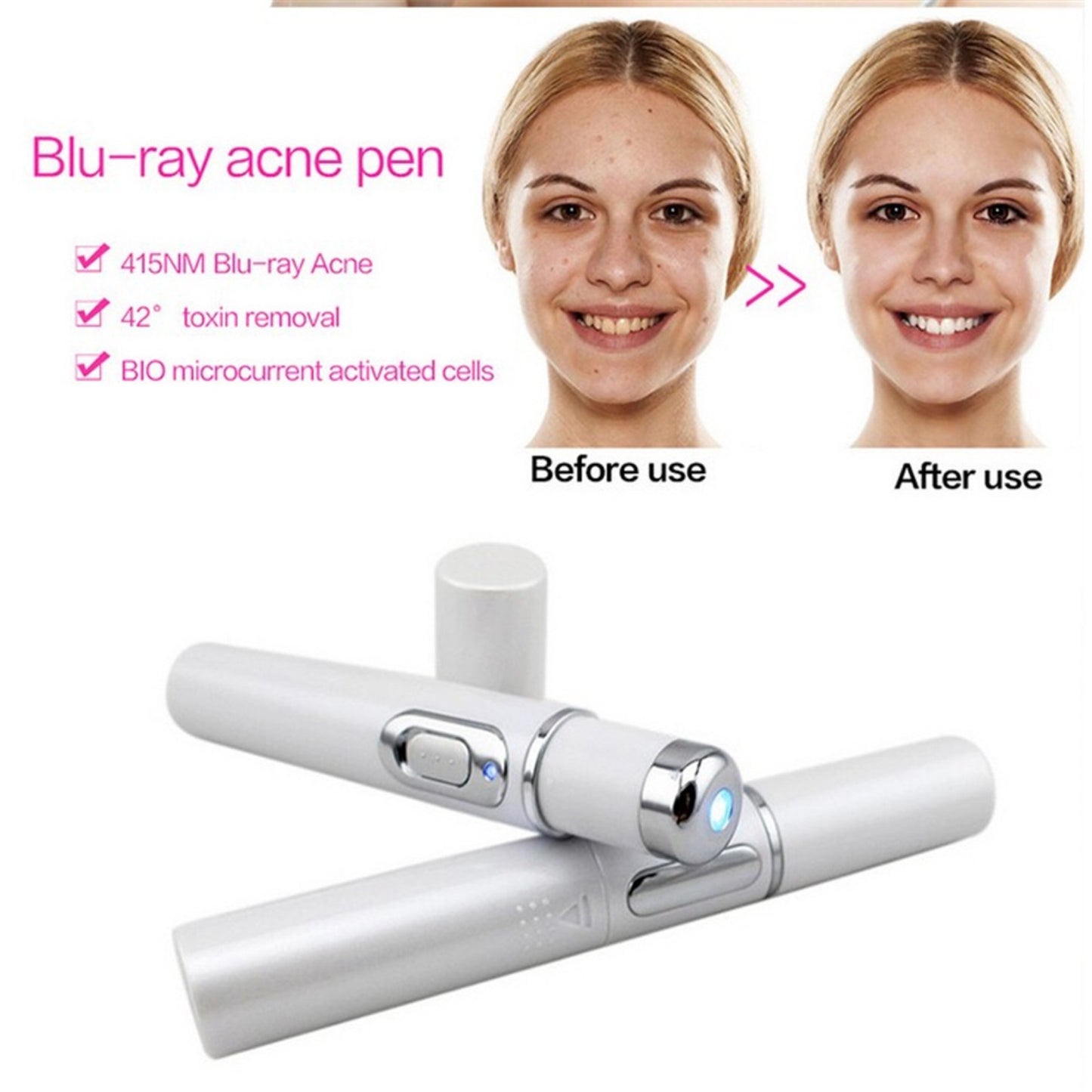 Laser Pen Soft Scar Wrinkle Removal