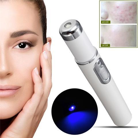 Laser Pen Soft Scar Wrinkle Removal